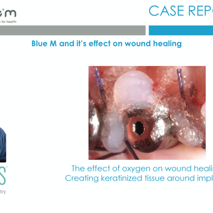 BlueM_case_report_EN_Abas_3_creating_keratinized_tissue_around_implants-_oral_gel_2017-1