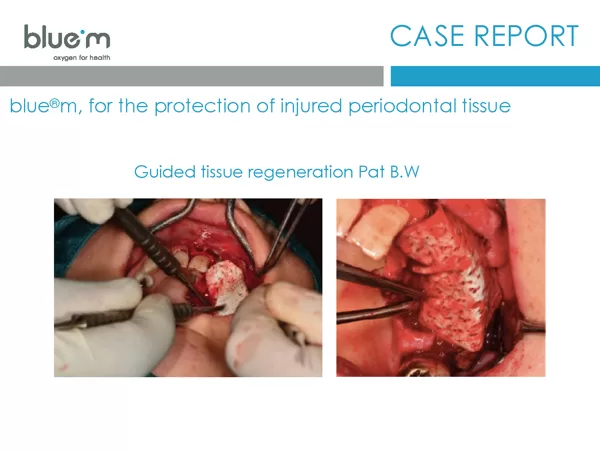 BlueM_case_report_EN_Dentalline_1_GTR_oral_gel_2017-1.pdf