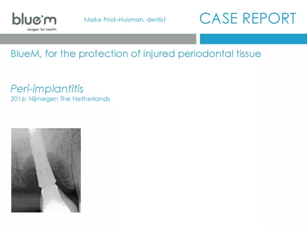 BlueM_case_report_Maike_Huisman_1_peri-implantitis_November_2016.pdf