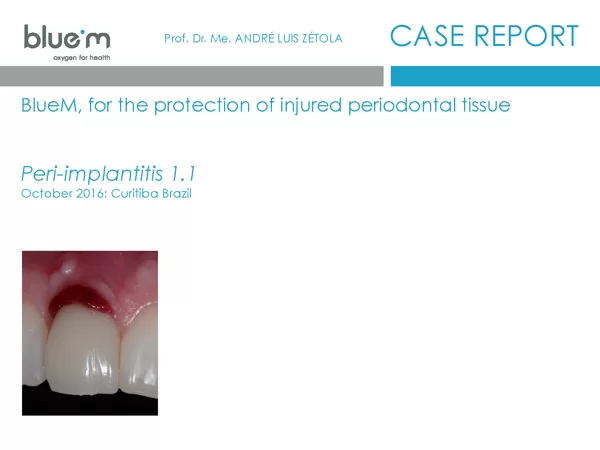 BlueM case report Maike Huisman 1 peri-implantitis November 2016